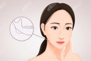 削骨这事儿变天了：不流血、少遭罪、恢复快的高科技脸型重塑术
